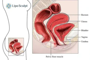 Treatment For A Leaky Bladder 2 How EM Chair treatment Ashford can help Leaky bladder issues. Read more now!