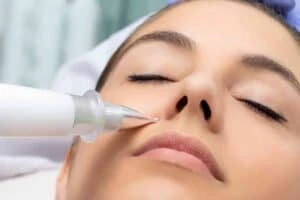 Best Actinic Keratoses Removal 3 Actinic keratoses Ashford solutions - book in today!