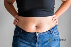 Bidding Farewell to Muffin Tops with Aqualyx Fat Injections 2 Do you wish you could reduce your muffin top Ashford With Aqualy fat dissolving injections you can!