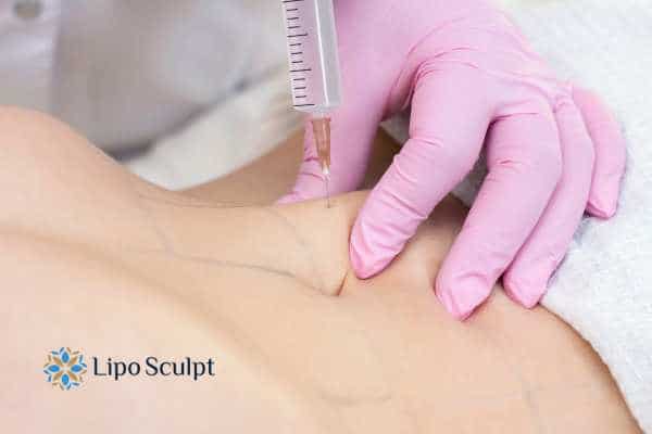 Aqualyx for Muffin Tops: What to Know Before Fat-Dissolving Injections 4 Are there risks Ashford?