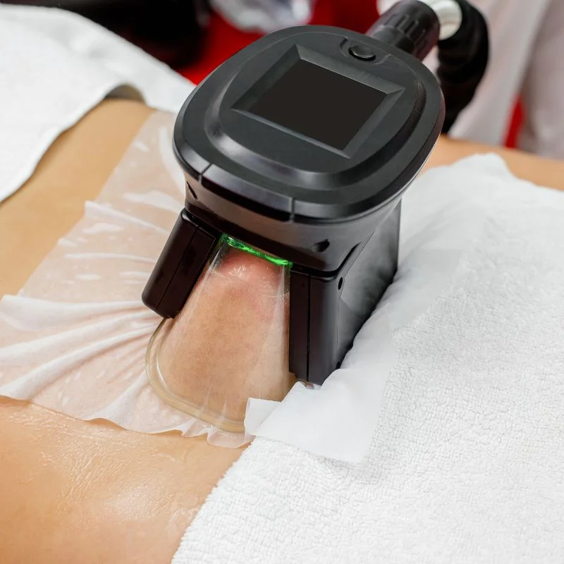 Fat Freezing treatment Ashford